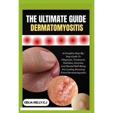 (영문도서)The Ultimate Guide Dermatomyositis: A Complete Step-By-Step Guide To Diagnosis ... Paperback, Independently Published, English, 9798266549814