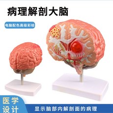 뇌모형 뇌 해부학 조립 신경학 과학실 분리 동맥 뇌구조 신경, 병리학 모델