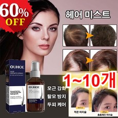 OUHOE 발모 미스트 모발성장에센스 모발성장 모발 영양제 50ML, 1개