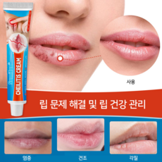 입술포진 연고 긴급구호 S-09, 20g, 2개, 20g