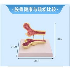 무릎관절 모형 해부학 연골 인대 골격 인공 인체 병원 관절, 무릎 해부학, 1개