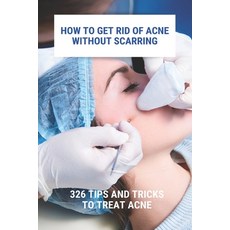 How To Get Rid Of Acne Without Scarring: 326 Tips And Tricks To Treat Acne: Natural Pimples Cure Paperback, Independently Published