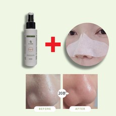 [에스지엔바이오] Dr.SGN 슈퍼클리어엑스로션 100ml+코솜 20매 저자극성 피지연화제 전용 초밀착 코화장솜 증정