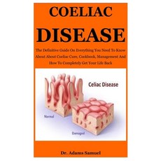 (영문도서) Coeliac Disease: The Definitive Guide On Everything You Need To Know About About Coeliac Cure... Paperback, Independently Published