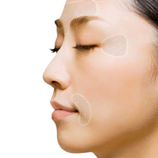 얼굴 테이프 패치 이마 미간 눈가 주름 부위별 시트형, NO.1