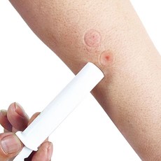 생활가전 해충퇴치기 뱀 벌 모기 독빼내기 휴대용펌프, 1개