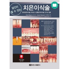 달인이 될 수 있는 치은이식술:유리치은이식술(FGG) & 결합조직이식술(CTG) 입문, OdaShigeru 저/신영민 역, 대한나래출판사