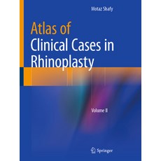 (영문도서) Atlas of Clinical Cases in Rhinoplasty: Volume II Hardcover, Springer, English, 9783031122705