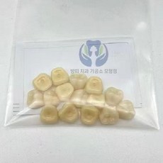 치아 임시 틀니 재료 치과 이빨 도자기 모형 만들기 떼우기