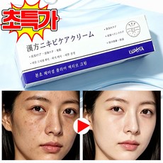 [당일배송] 기미 주근깨 제거 크림 책소침착 멜라논크림 기미 잡티 제거 검버섯 크림 LUPEIYA 신제품, 1개, 30ml