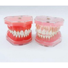 발치형 치아모형 치과 교정 덴티폼 모형 교육용 투명 7008, 어린이용 7009