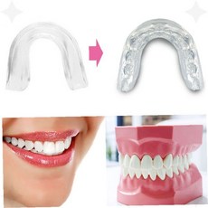 치아보호 투명 실리콘 마우스가드 수면 이갈이 교정 야간 착용 치아마모 예방, 1개