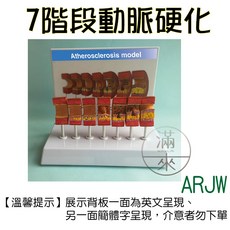教學用人體血管阻塞支架模型 動脈硬化血栓血管教學模型, 1個, 7階段動脈硬化模型ARJW