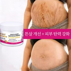 임신 크림 Stretch Mark Cream 임신부 바디 로션 산후 크림, 2개, 150g