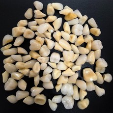 깨진이빨 가짜 이빨 임시 커버용 인공치아 치과 연습용 모형