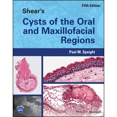 (영문도서) Shear's Cysts of the Oral and Maxillofacial Regions Hardcover, Wiley-Blackwell, English, 9781119354994