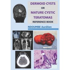 (영문도서)Dermoid Cysts or Mature Cystic Teratomas: Reference Book Paperback, Independently Published, English, 9798274953122