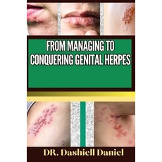 (영문도서) From Managing to Conquering Genital Herps: Expert Guide To Understanding the Causes Recogniz... Paperback, Independently Published, English, 9798873239801