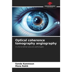 (영문도서) Optical coherence tomography angiography Paperback, Our Knowledge Publishing, English, 9786208276058