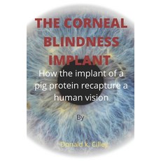 (영문도서) The Corneal Blindness Implant: How the implant of a pig protein recapture a human vision Paperback, Independently Published, English, 9798846819634