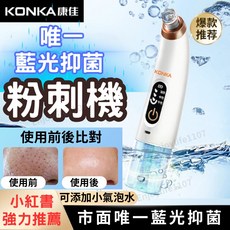 KONKA 康佳 藍光抑菌 粉刺機