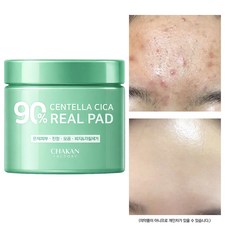 착한팩토리 트러블 모공 진정 각질 피지 센텔라시카 90% 리얼 토너패드, 1.센텔라시카 90% 리얼 토너패드 1개, 1개, 70매입