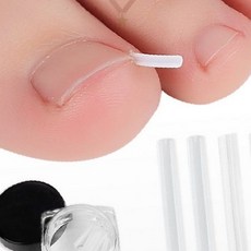 발톱 관리 내성 교정 스틱 10개 휨방지 발 건강 케어 젤, 1개