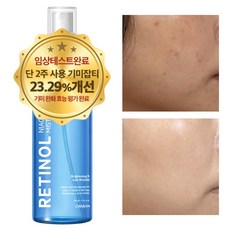 기미 주근깨 색소침착 미백 수분 보습 레티놀 나이아신아마이드 미스트세럼, 1개, 150ml