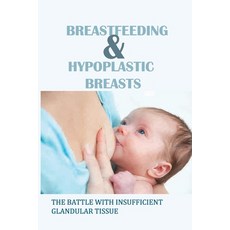 (영문도서) Breastfeeding & Hypoplastic Breasts: The Battle With Insufficient Glandular Tissue: Breastfee... Paperback, Independently Published, English, 9798505789834