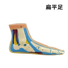 모형 관절 세트3개손글씨 인대 신경 혈관 해부 발 근육 해부 족저근, C. 평발 1 새로운 버전의 글자