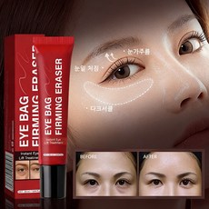 팔자주름 제거 크림1위 눈밑지방크림 아이백 크림 눈밑꺼짐 비립종 제거 연고 비립종 제거 크림 눈 밑 지방 제거 크림 아이크림 눈밑지방 아이백 리프팅 아이크림 눈가주름크림, 2개, 20ml