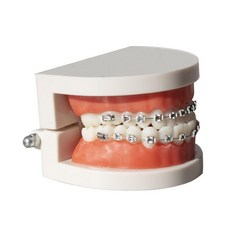 치과 치아 교정 모델 틀니 실습 교육 모형