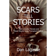 Scars Tell Stories: From a Cystic Fibrosis and Heart/Double Lung Transplant Patient Paperback, Independently Published