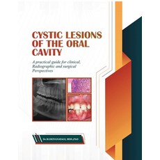 (英文圖書)Cystic Lesions of the Oral Cavity: A Practical Guide for Clinical Radiographic... 平裝版, Notion Press, 英文