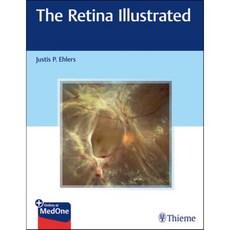 The Retina Illustrated, Thieme Medical Publishers