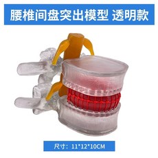 모형도 디스크 요추 탈출 화이트 뼈모형 정형외과 추간판, A. 요추 척추 혈액 세포 수투명 버전