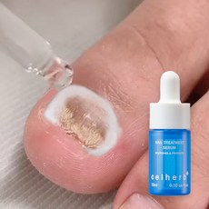 문제성 손발톱 전문케어 셀허브 리페어 세럼 손톱영양제 10ml, 1개