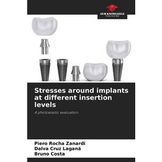 (영문도서)Stresses around implants at different insertion levels Paperback, Our Knowledge Publishing, English, 9786208808365