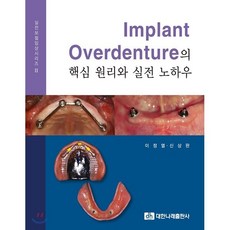 Implant Overdenture의 핵심 원리와 실전 노하우, 대한나래출판사, 이정열