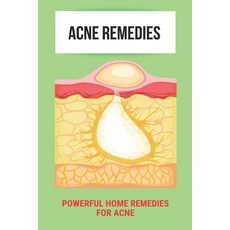 Acne Remedies: Powerful Home Remedies For Acne: Blackheads Treatment Paperback, Independently Published, English, 9798737852290
