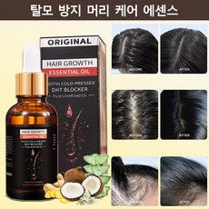 생강 두피 에센스 헤어 영양제 두피케어 앰플 모발 성장 헤어라인 구렛나루 촉진제 헤어오일, 1개, 30ml