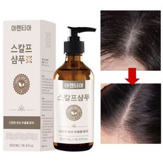 지루성 두피염 샴푸 여성 샴푸 1 위 향기좋은샴푸 비듬 샴푸 비듬균 제거 두피 가려움 개선 약산성 샴푸 손상모 샴푸 여자 남자 비듬샴푸 1위 남자 비듬샴푸 1위 두피 스케일링 샴푸, 1개, 500ml