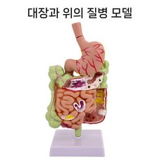 인체 치질 모형 직장 항문외과 병리학 해부학, 위+대장 모델, 1개