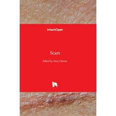 (영문도서)Scars Hardcover, Intechopen, English, 9781838809348