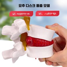 요추 디스크 모형 모델 교육용 척추 인체 해부학 인체 교구, 1개, 화이트 모델
