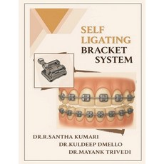 (영문도서)Self Ligating Bracket System Paperback, Notion Press, English, 9798898265724