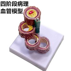 혈관 모형 심혈관계 단면 개의 해부학 네 기관 보건 혈관 경화, B. 4 개의 혈관, 1개