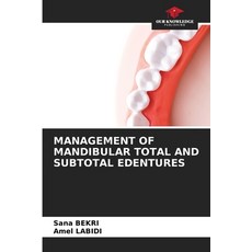 (영문도서)Management of Mandibular Total and Subtotal Edentures Paperback, Our Knowledge Publishing, English, 9786208850227