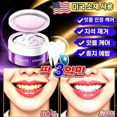 프로바이오틱 퍼플 분말치약 치아착색제거 구강청결 셀프 구강케어 양치가루, 1개
