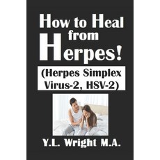 How to Heal from Herpes! (Herpes Simplex Virus-2 HSV-2): How Contagious Is Herpes? Is There a Cure ... Paperback, Independently Published, English, 9798597593784
